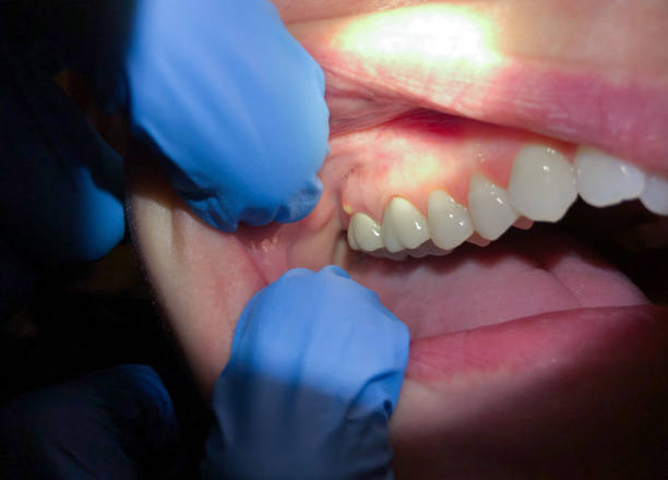 Professional Emergency Dental Service in TN