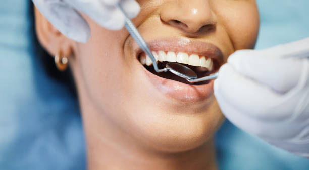 Best Emergency Dental Care for Sports Injuries in Etowah, TN
