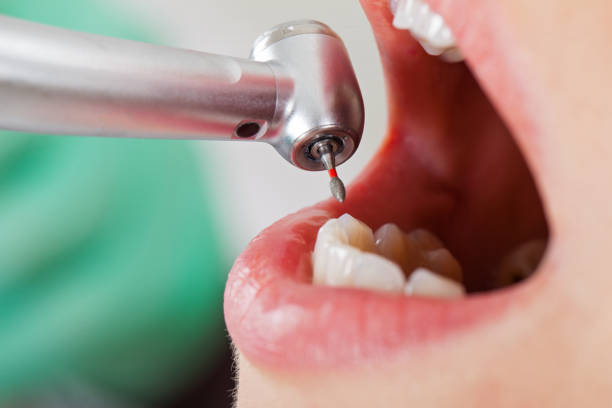 Best Walk-In Emergency Dental Services in Etowah, TN